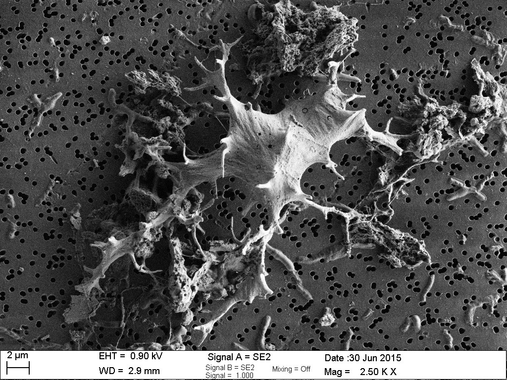 Digging up bones for science – looking into 48 million years old blood vessel-like structures