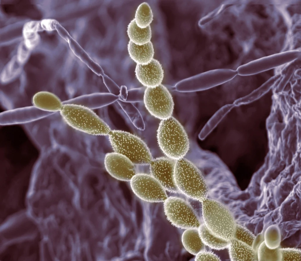 Imaggeo on Mondays: The invaluable role of soil dwellers