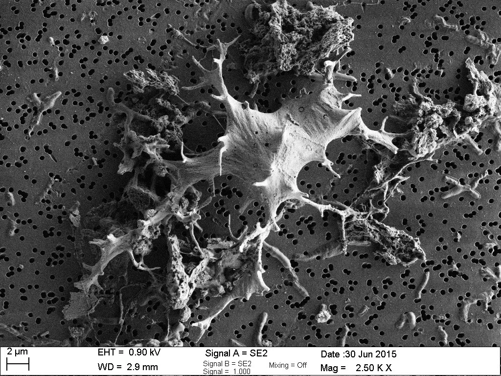 Digging up bones for science – looking into 48 million years old blood vessel-like structures