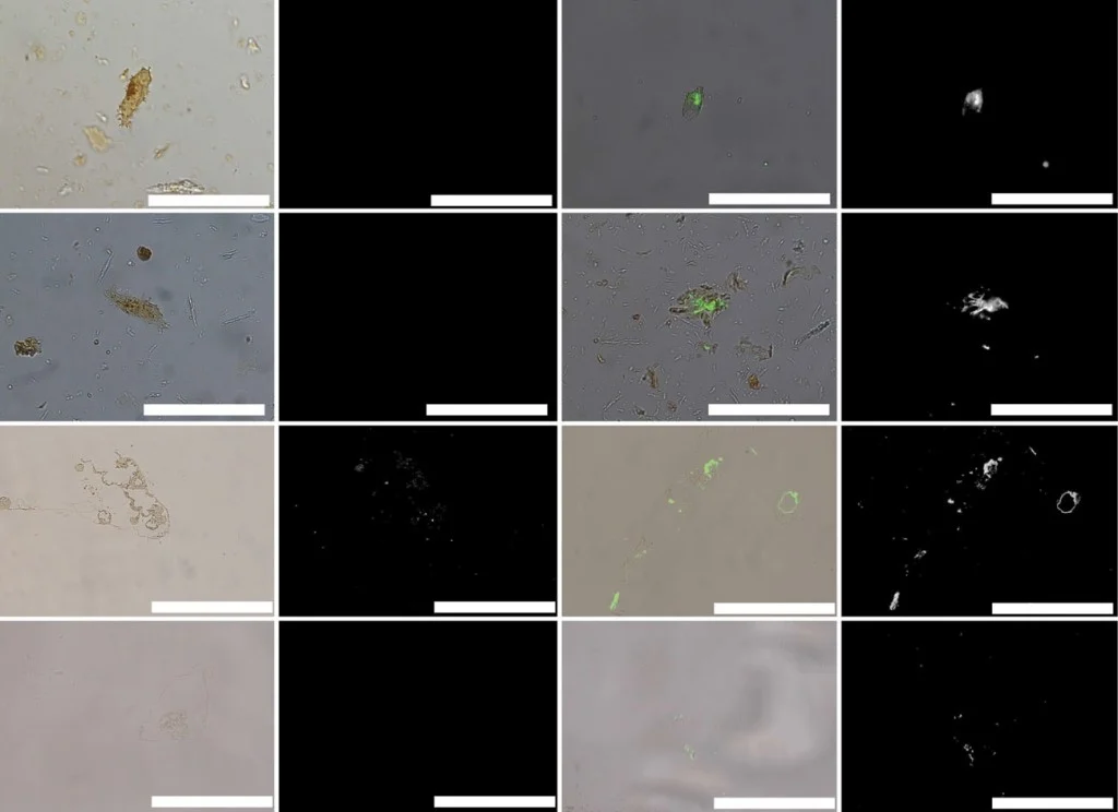 Overlay and fluorescence microscopy images of dinosaur ‘osteocytes’ and vessels after exposure to polyclonal antibodies. (a–h) Cells exposed to antibodies against actin protein; (i–p) vessels exposed to antibodies raised against elastin protein, a component of vessel walls. (a,b) Brachylophosaurus canadensis and (e,f ) T. rex osteocytes show minimal reactivity to antibodies before treatment with PIH; treatment with the iron chelator PIH result in increase in binding to actin antibodies in both B. canadensis (c,d ) and T. rex (g,h) isolated osteocytes. Similar increase in antibody binding is visible in dinosaur vessels. (i,j ) isolated vessel from B. canadensis exposed to elastin antibodies without PIH; binding is greatly increased after chelation (k,l ). A similar pattern is seen for T. rex vessels before (m,n) and after chelation (o,p). All data collection parameters are identical for each condition. Scale bar is 50 mm for each image. (Online version in colour.)